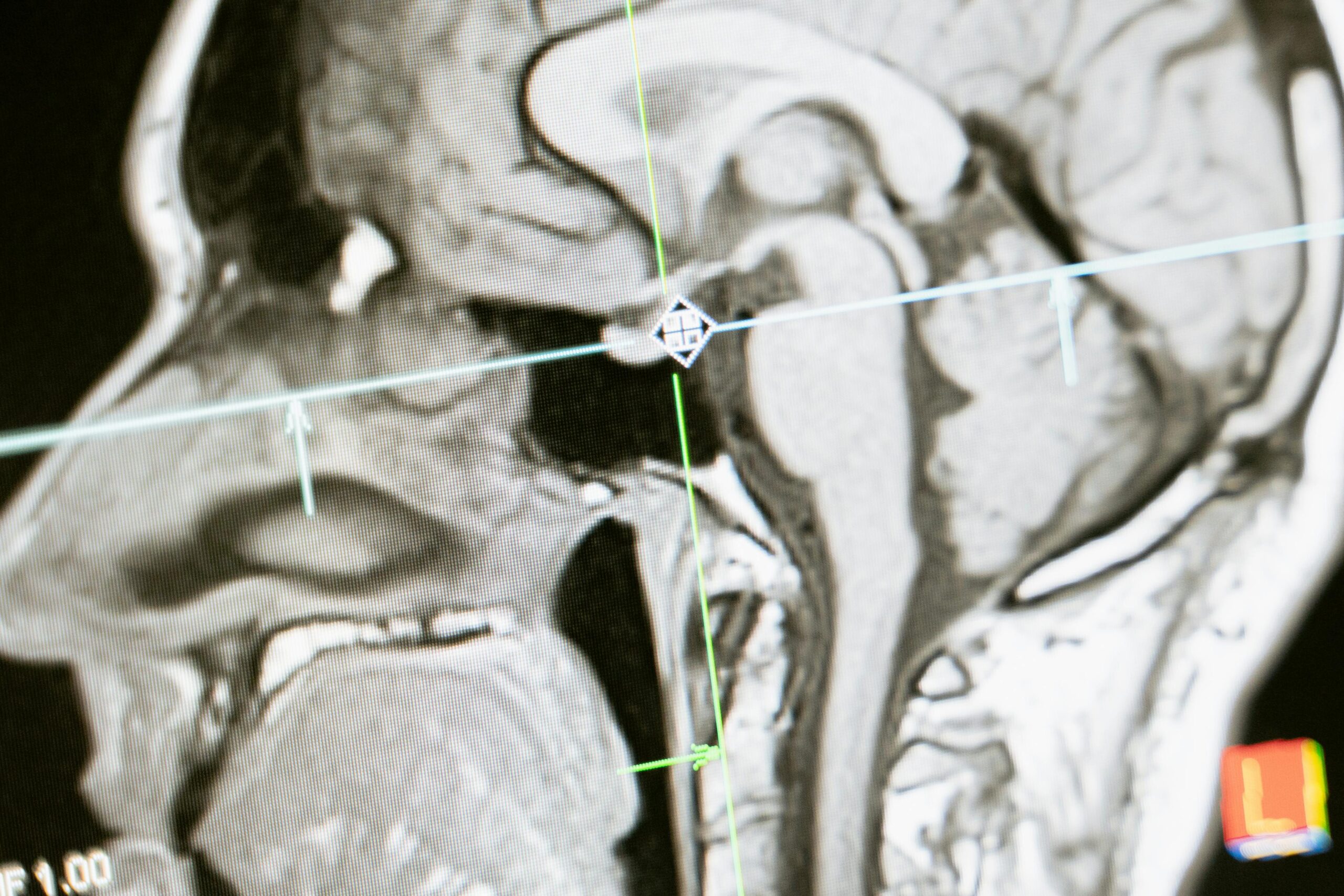 tina jones neurological shadow health
